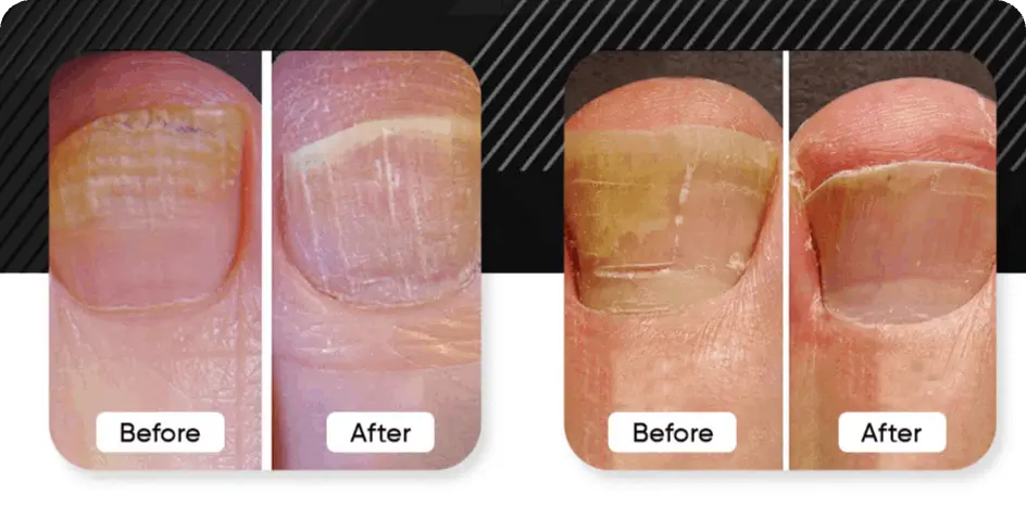Swissklip Heavy Duty Toenail Clipper benefits